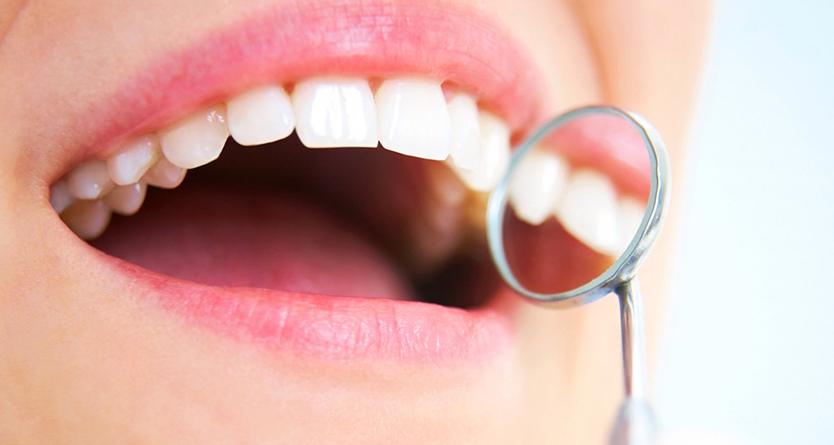 Teeth Whitening